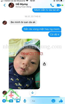 Đánh giá thuốc mỡ Minh Hùng tại Điện Biên